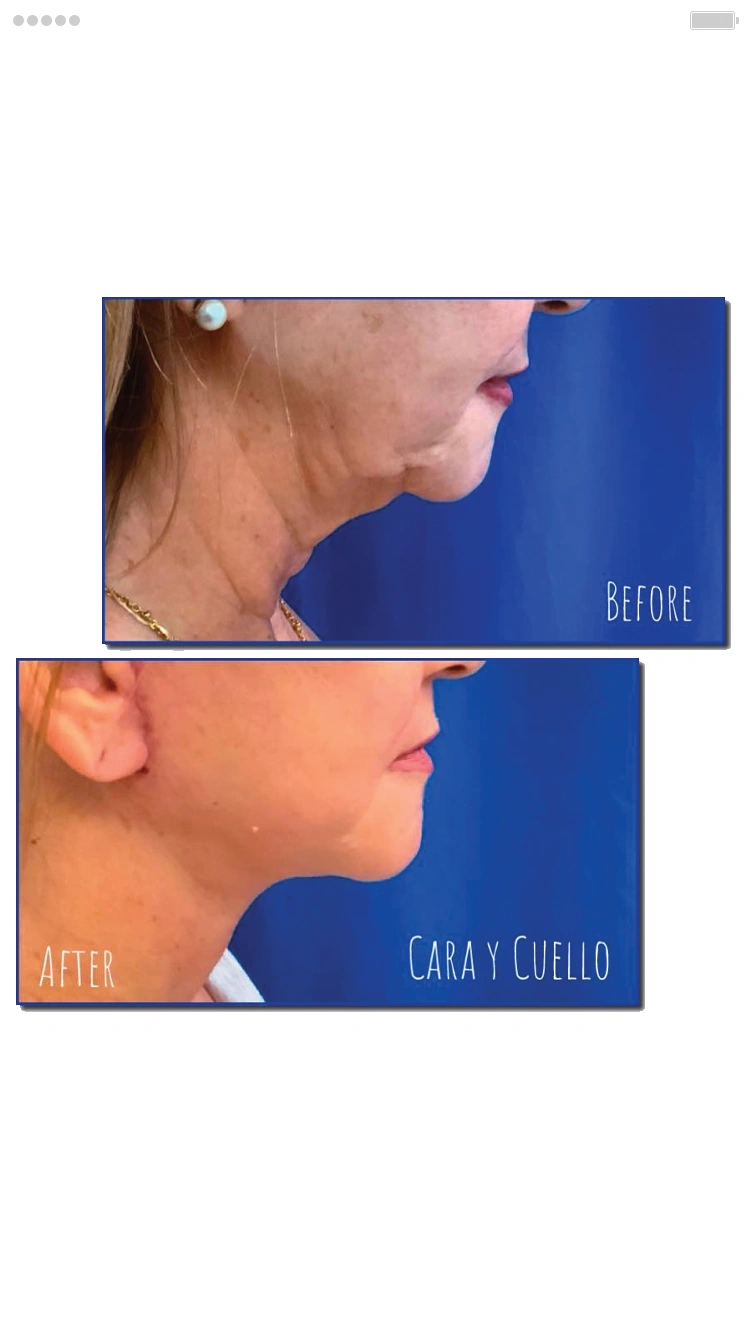 Face and Neck Surgery